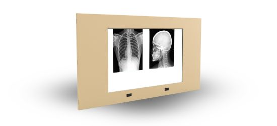 X ray film viewer