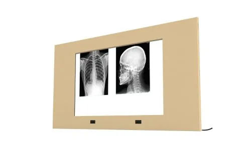 X ray Viewer - blog img