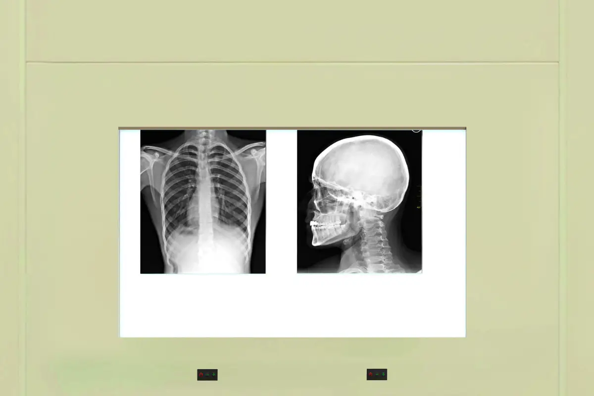 X-Ray Viewer- page 01