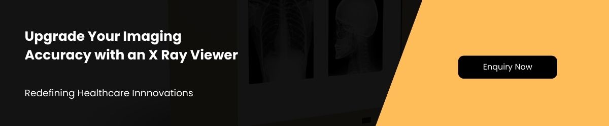 x ray viewer manufacturer blog ad
