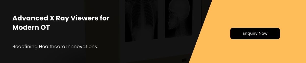 x ray viewer manufacturer - blog ad